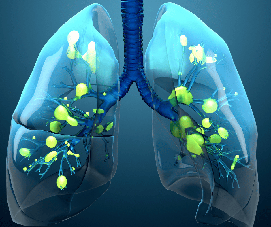 Acute Respiratory Infection