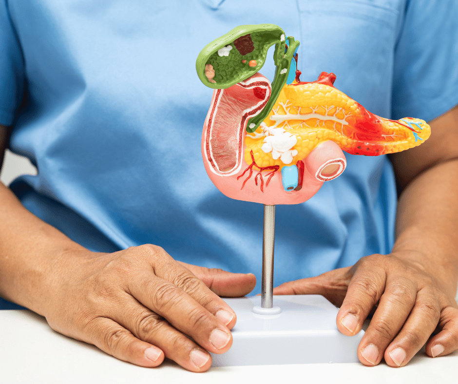 Acute pancreatitis.