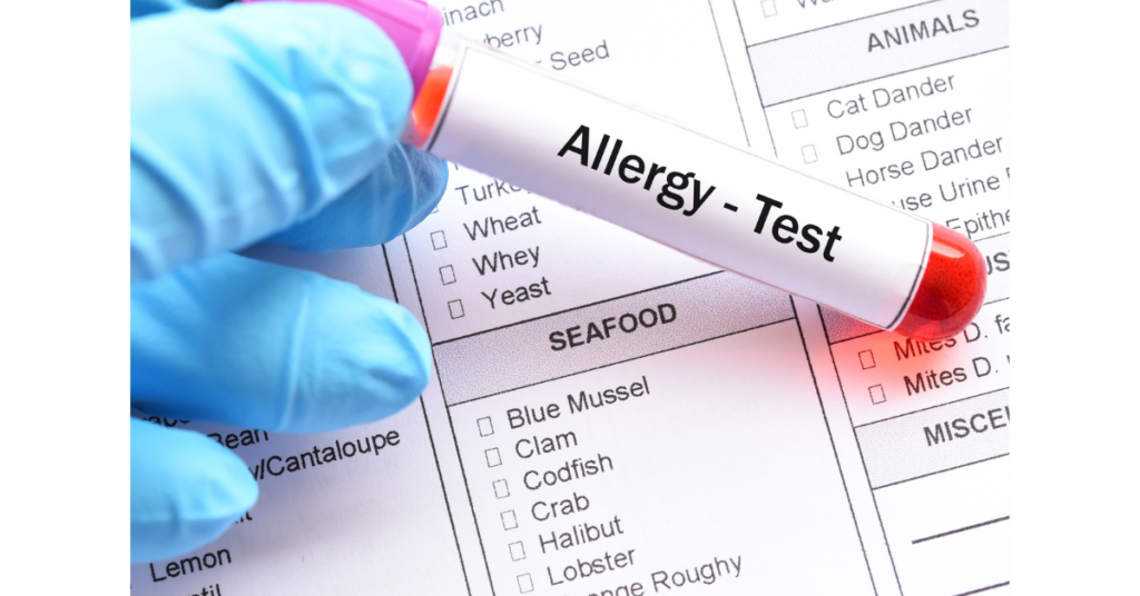 Allergy Testing Therapy