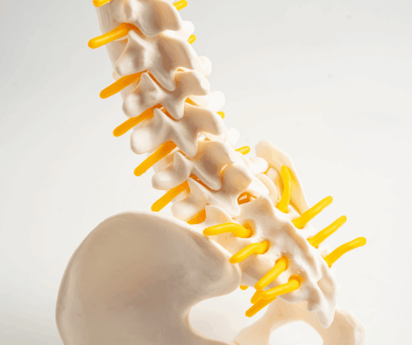 Ankylosing spondylitis