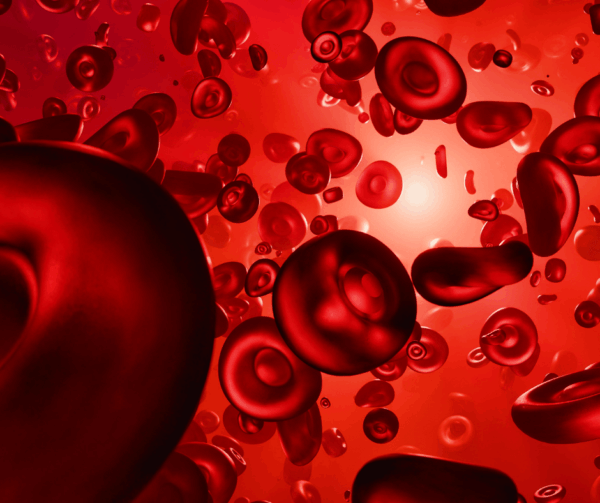 Aplastic Anaemia